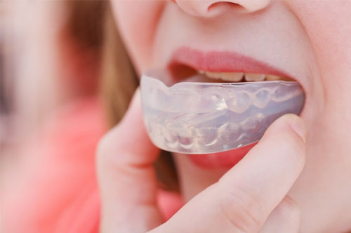 Invisalign and Its Benefits