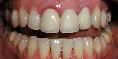 Image for Bridge Replacement