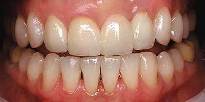 Image for Bridge Replacement